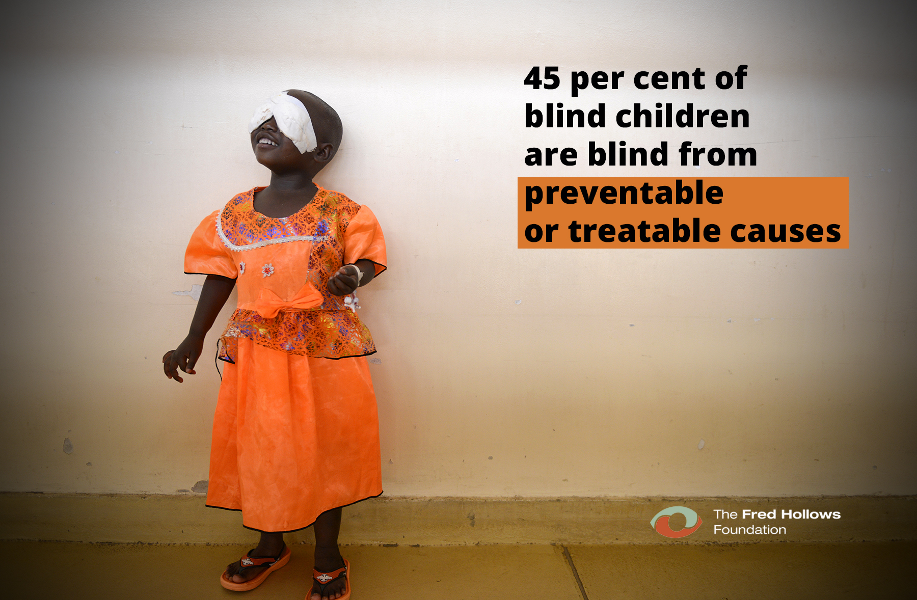 45%25 of blind children are blind from preventable causes