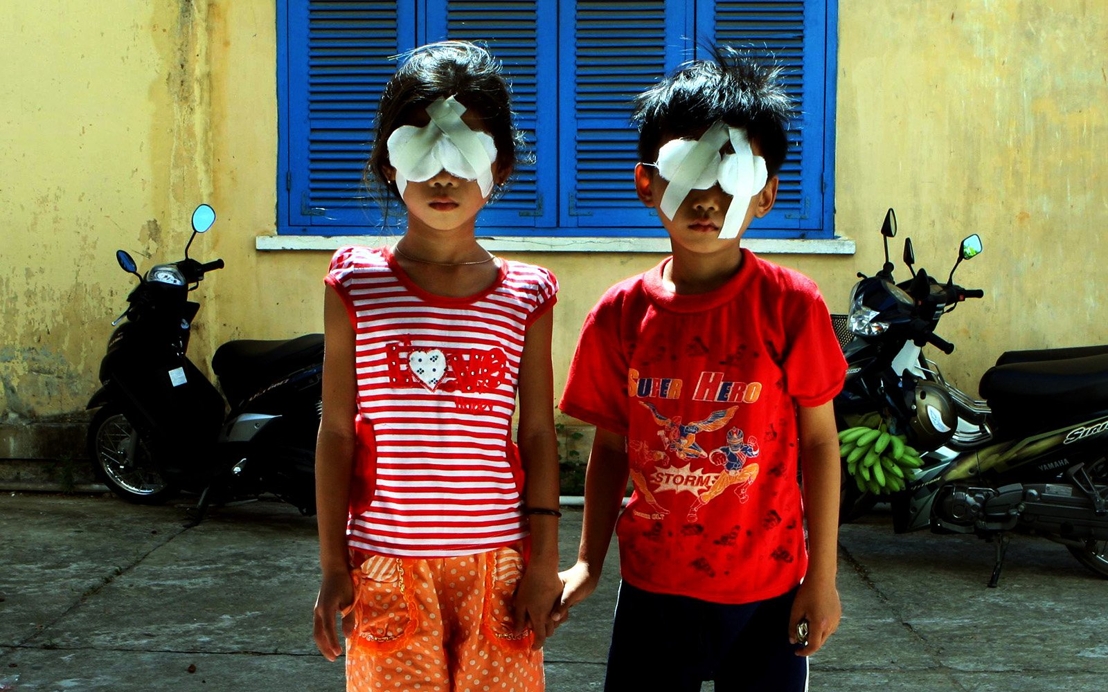 Children recovering from eye surgery