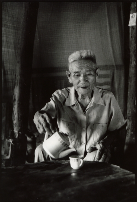 Our story begins with sight restored. In 1993, Do Ngoc Binh celebrated after successful cataract surgery in Vietnam, one of the many people whose sight Fred’s work helped restore.