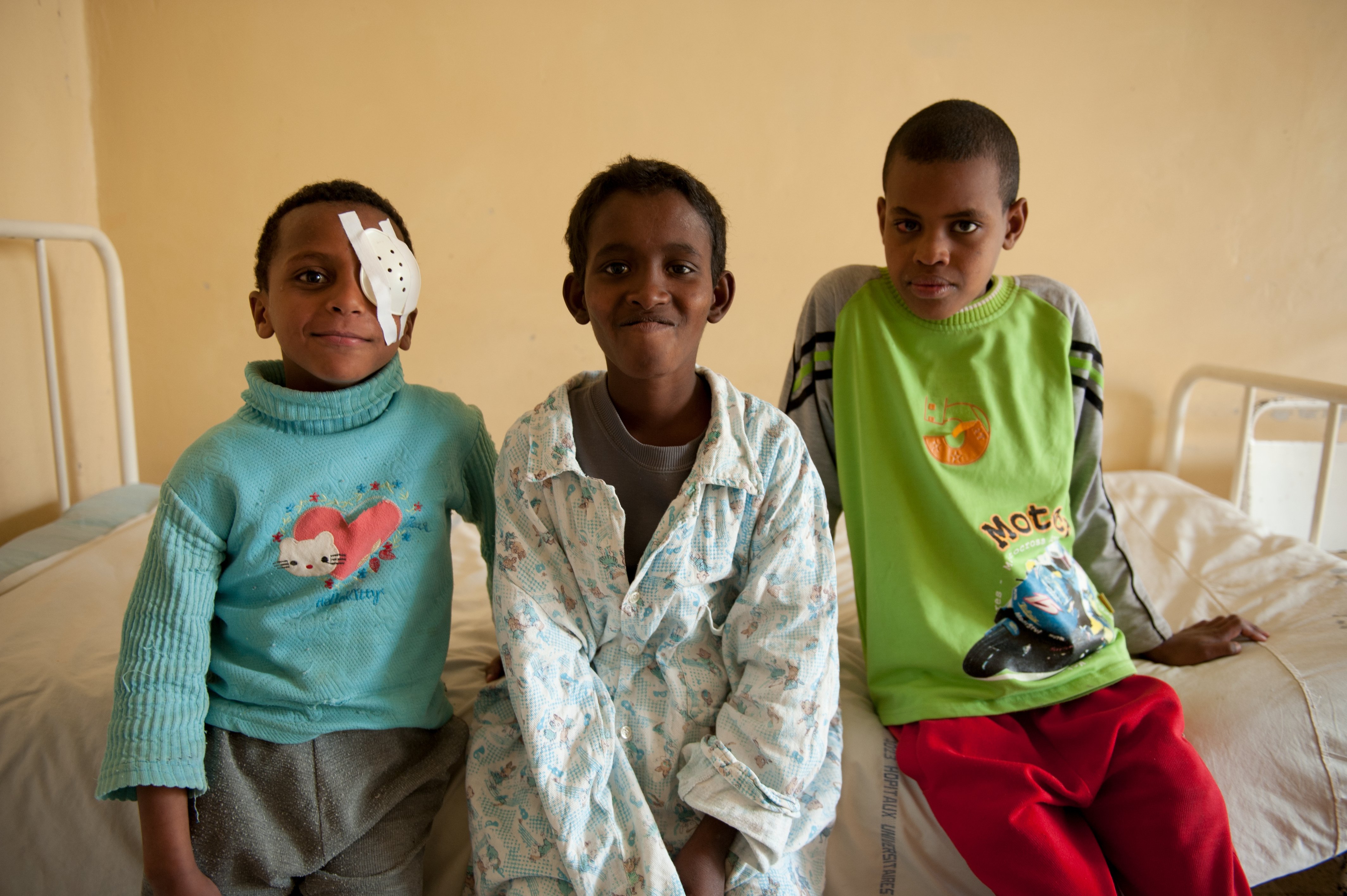 children smile, one with an eye patch after cataract surgery.