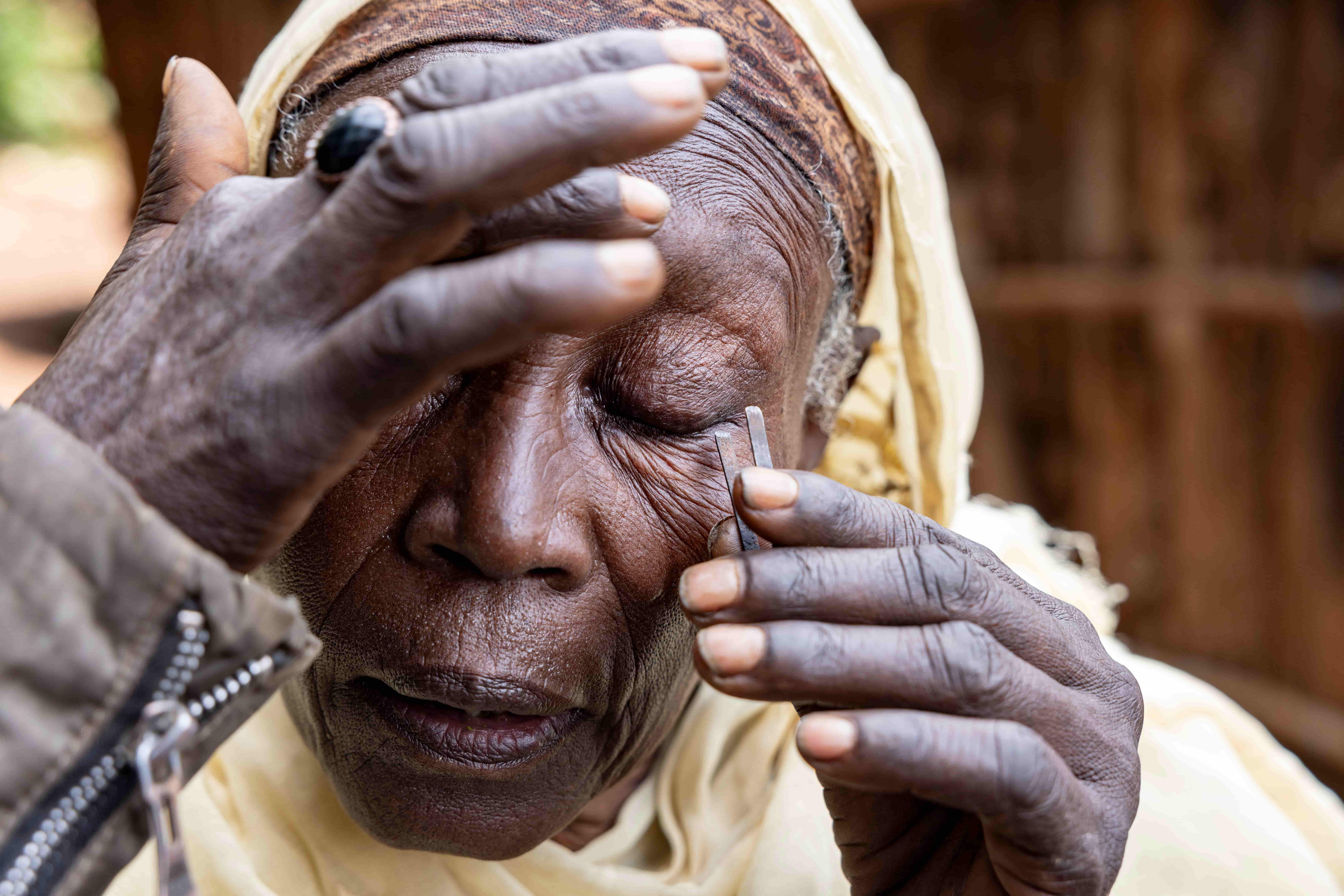 Semira in Oromia, Ethiopia, receiving trachoma treatment from a local outreach team.