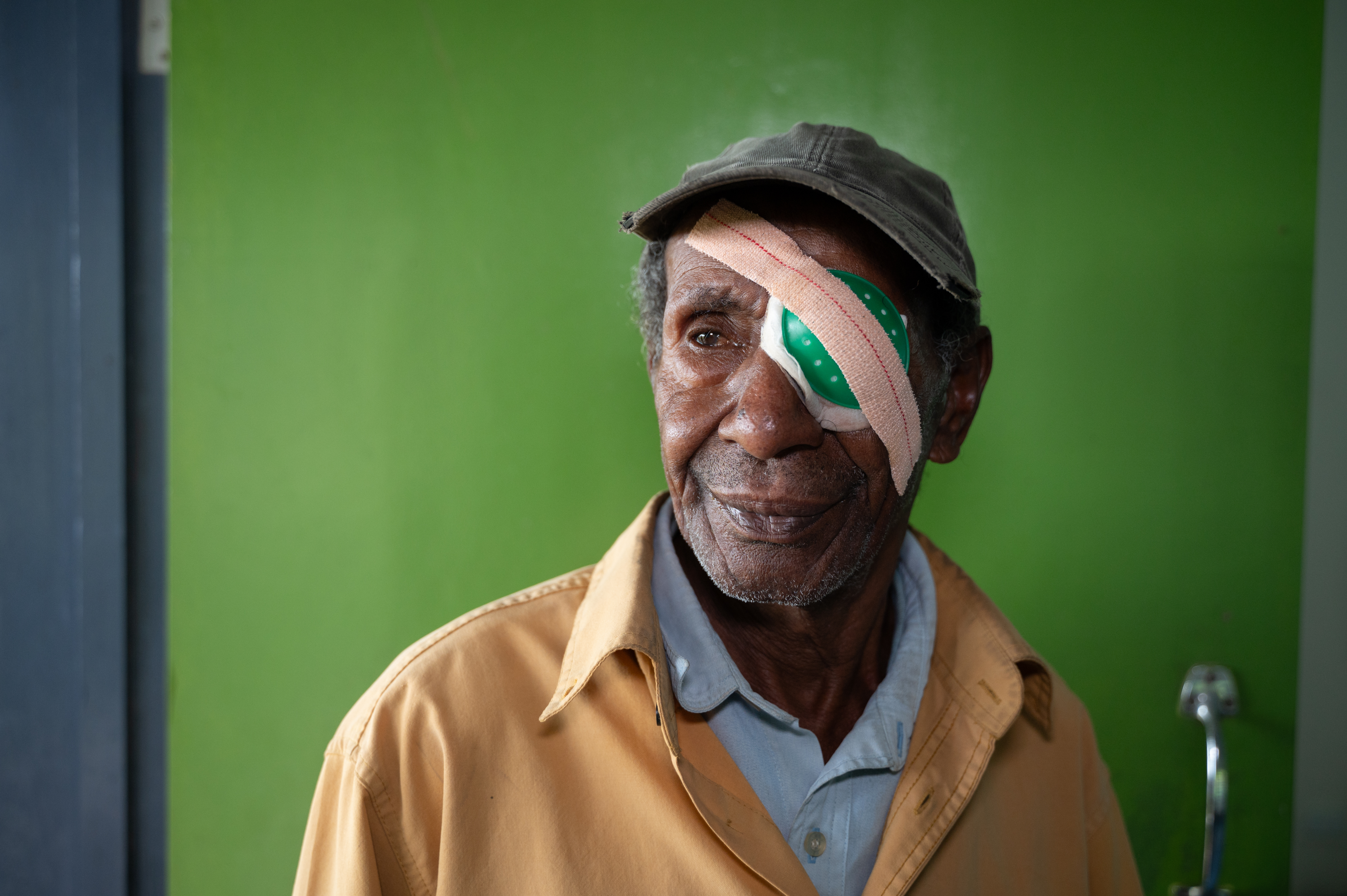 A man from PNG after eye surgery