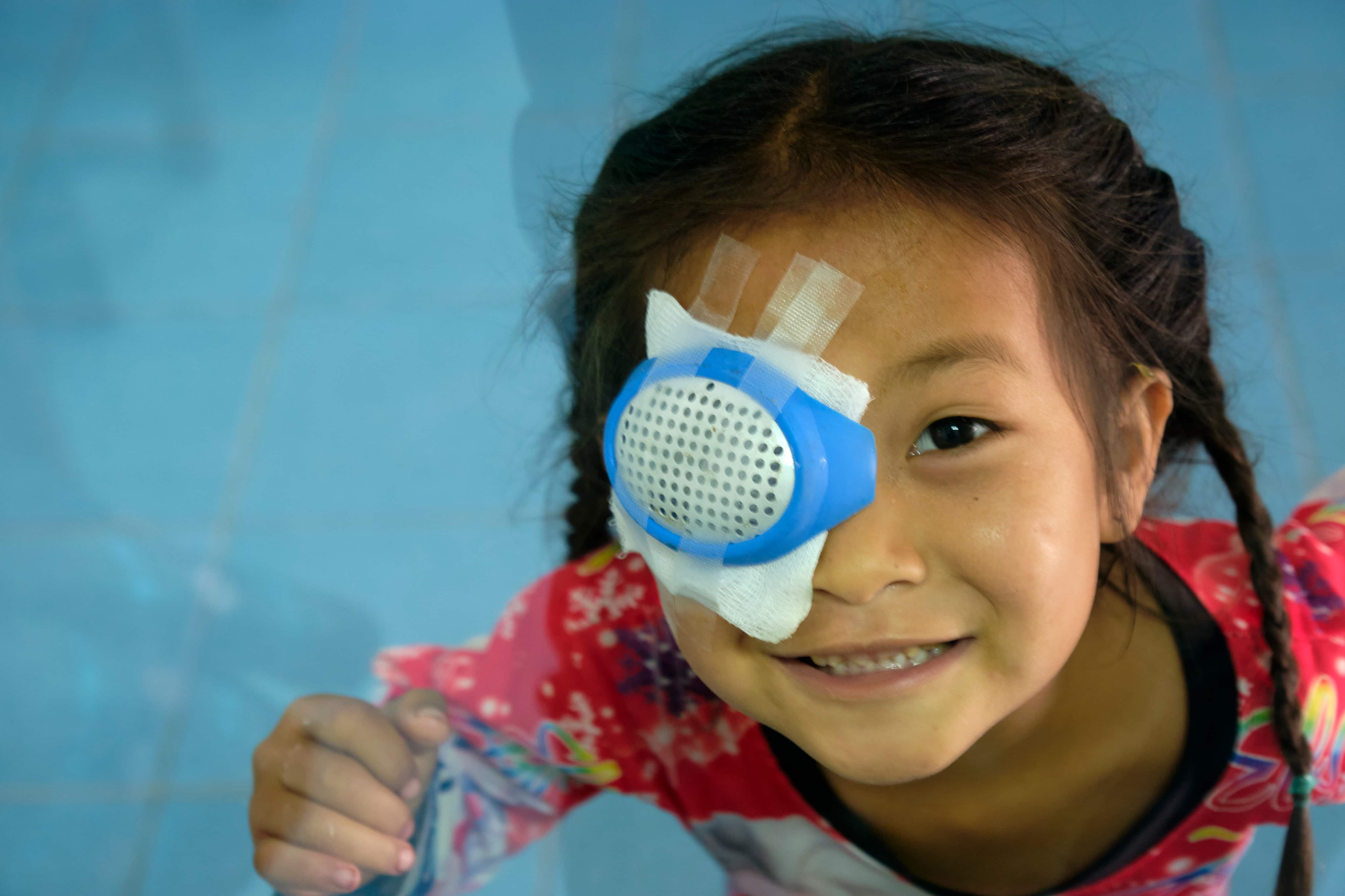 Chansouk, 6, from Oudomxay, Laos, developed a traumatic cataract after an explosion left her injured when she was just two years old. After struggling with her vision for years, cataract surgery restored sight in her right eye.