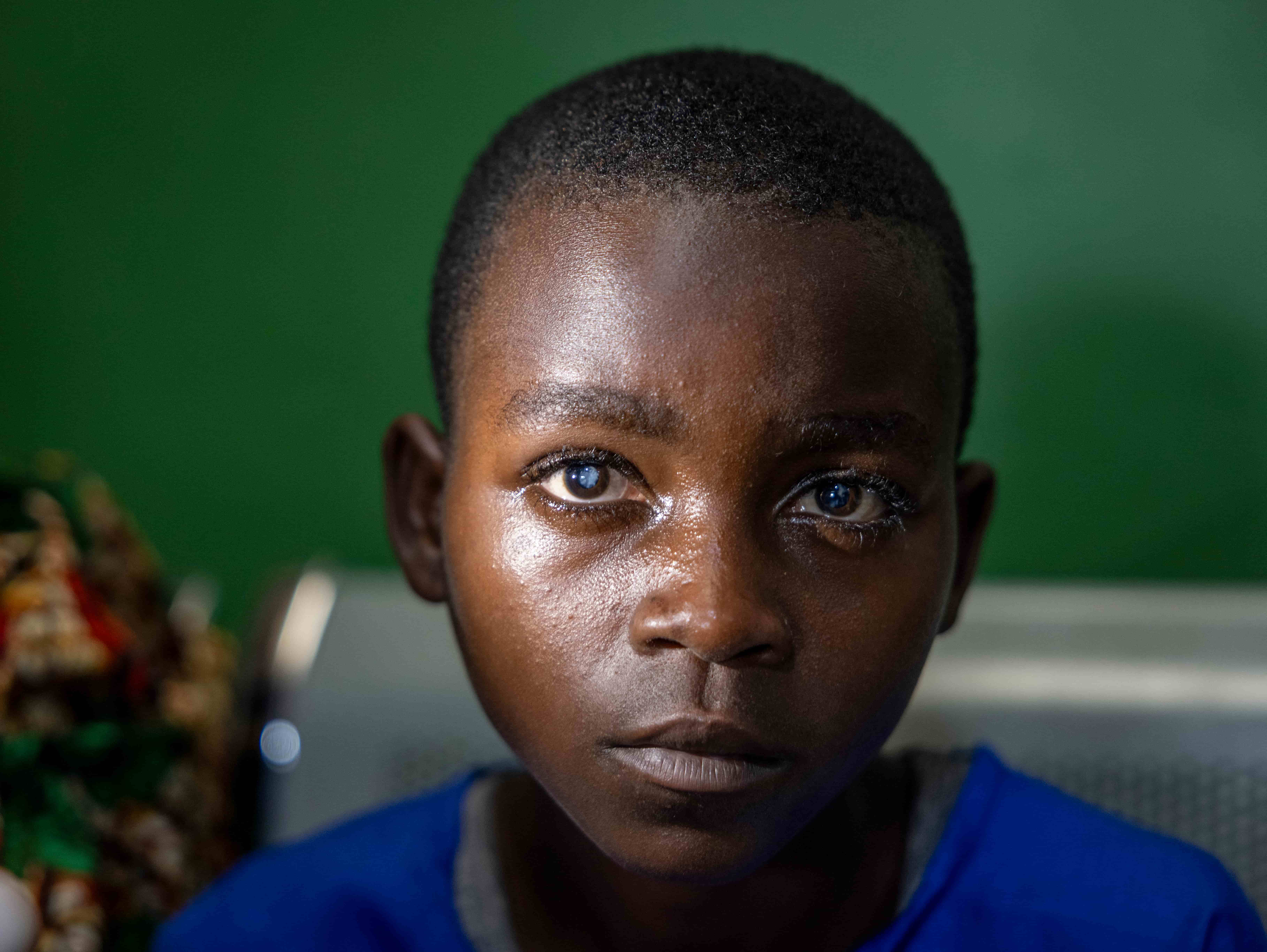 Valentine, 12, from Rwanda, regained her sight after cataract surgery supported by The Fred Hollows Foundation and ANCP. The treatment has transformed her ability to learn at school and restored independence for her family.