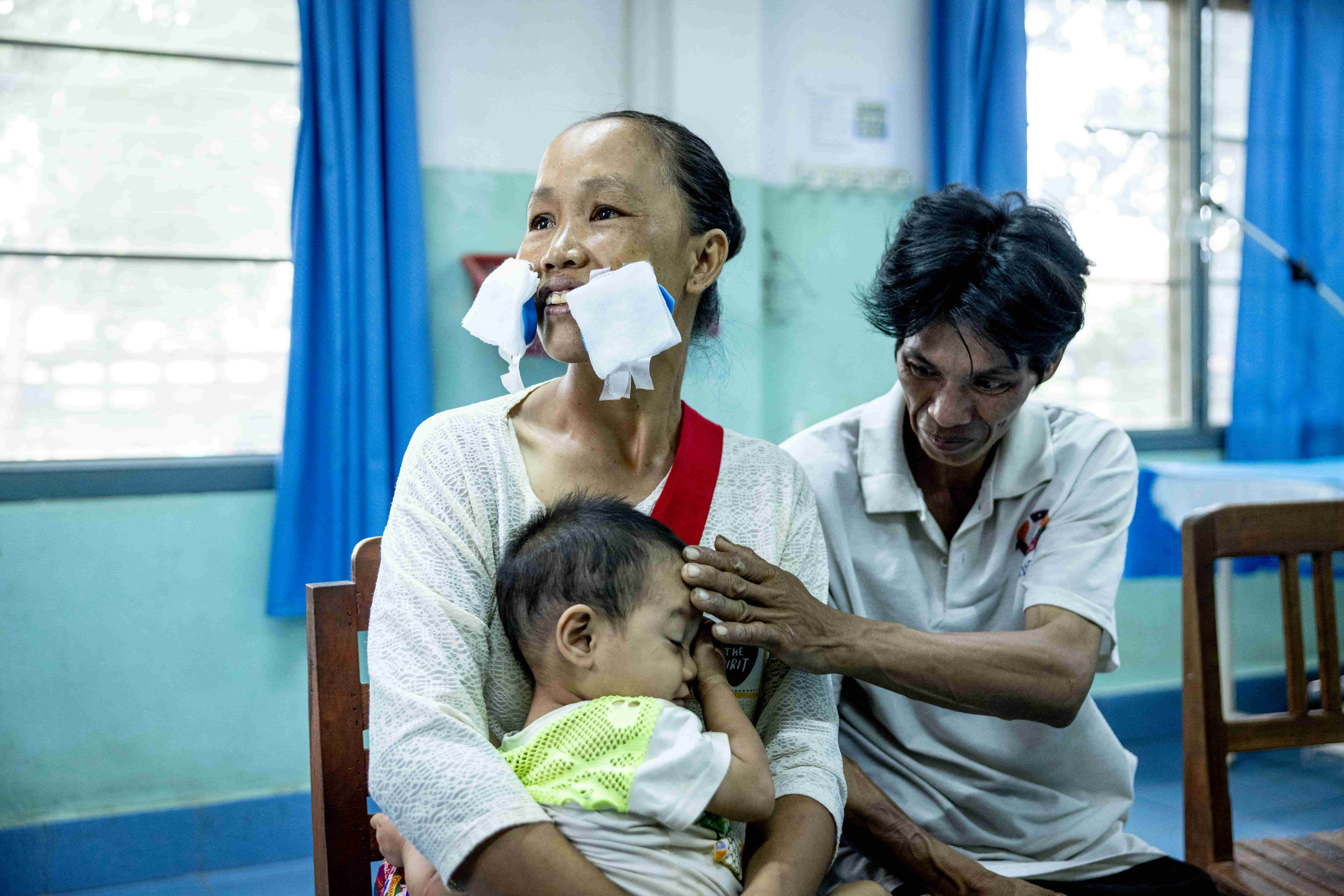 Lien after cataract surgery