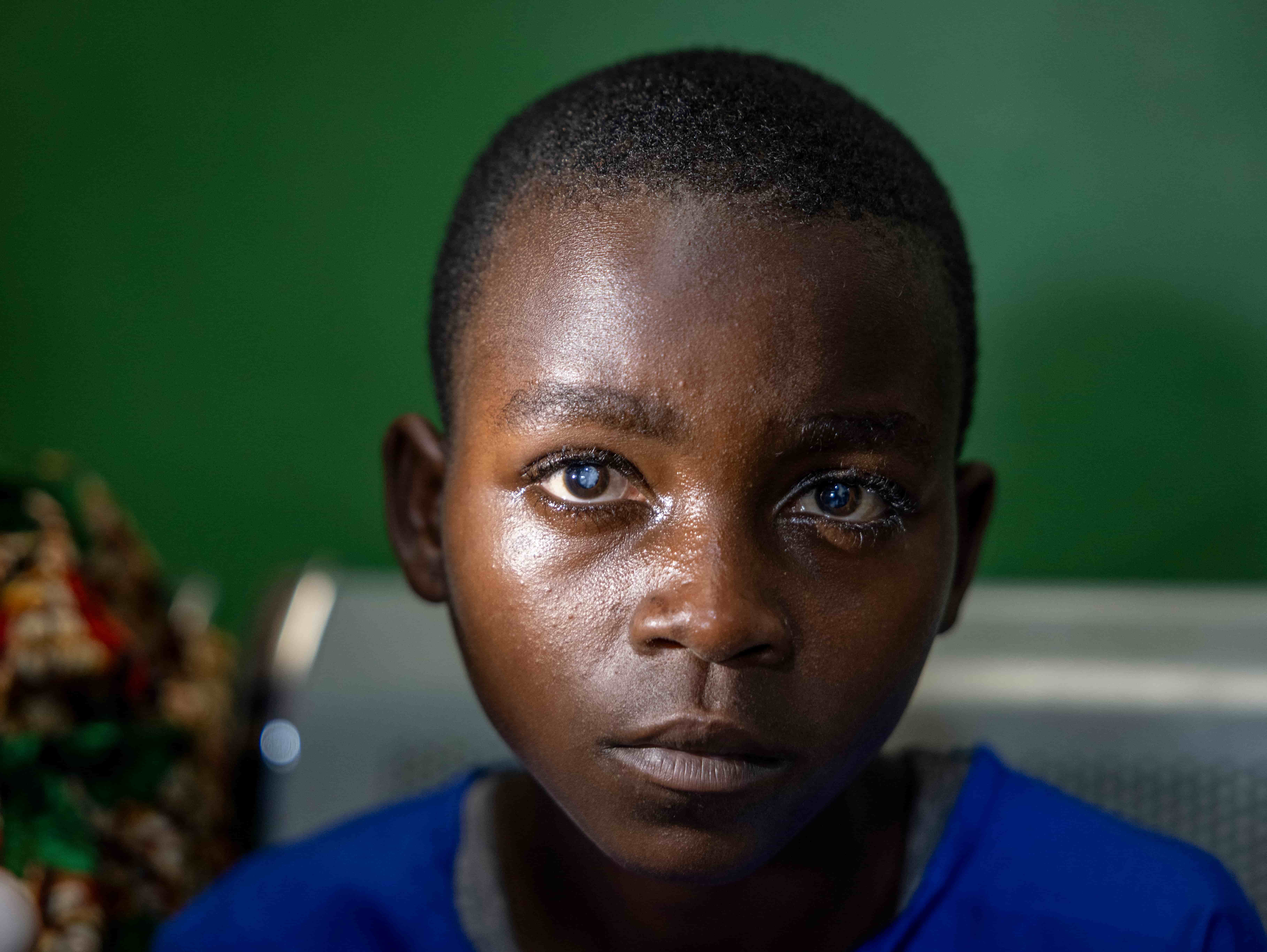 Valentine once struggled to see the blackboard in Rwanda. After surgery at Kabgayi Eye Unit supported by the Australian NGO Cooperation Program and Dr Tuyisabe Theophile, she can see and learn again.
