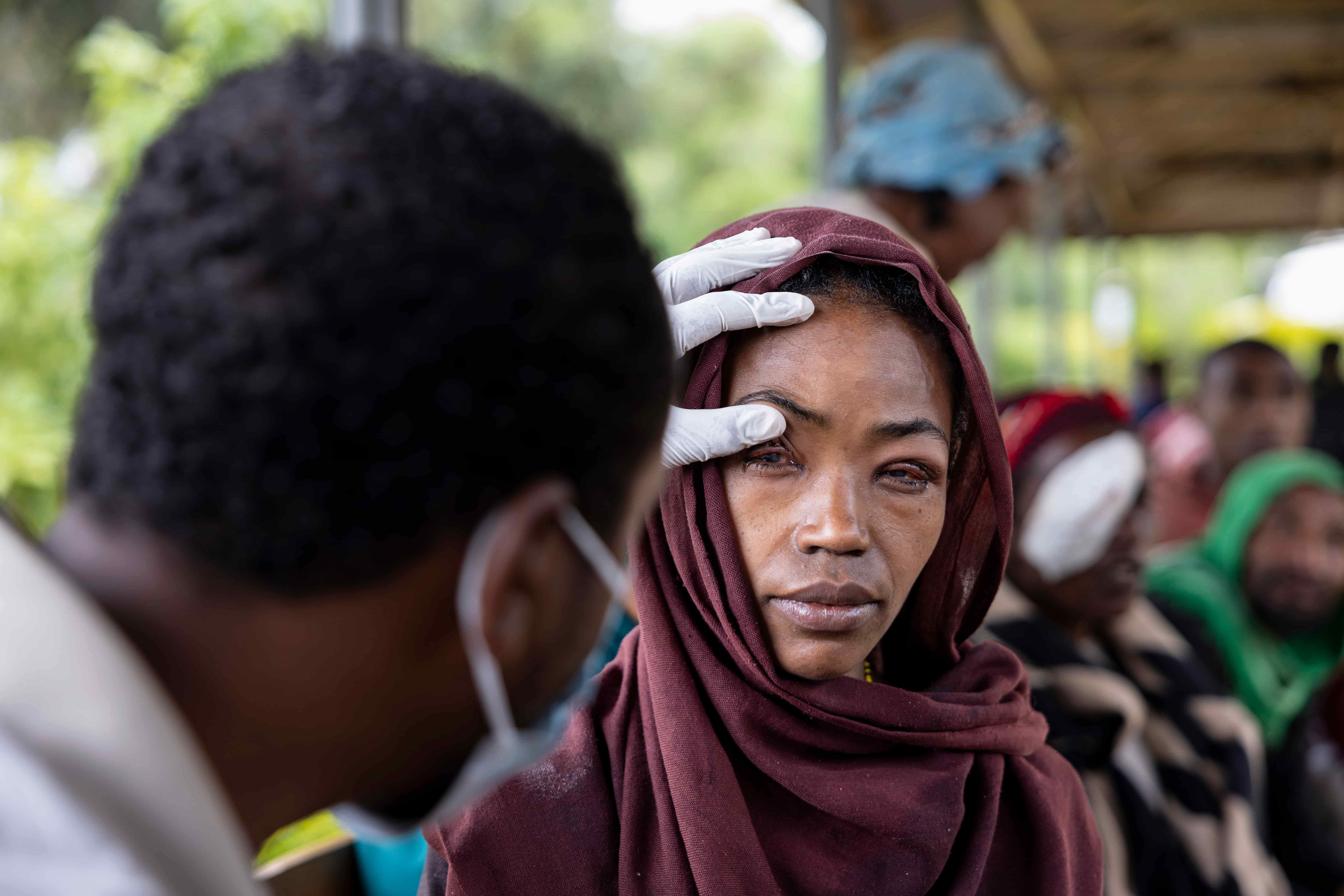 ethiopia-2023_trachoma-semira_8192x5464px.jpg