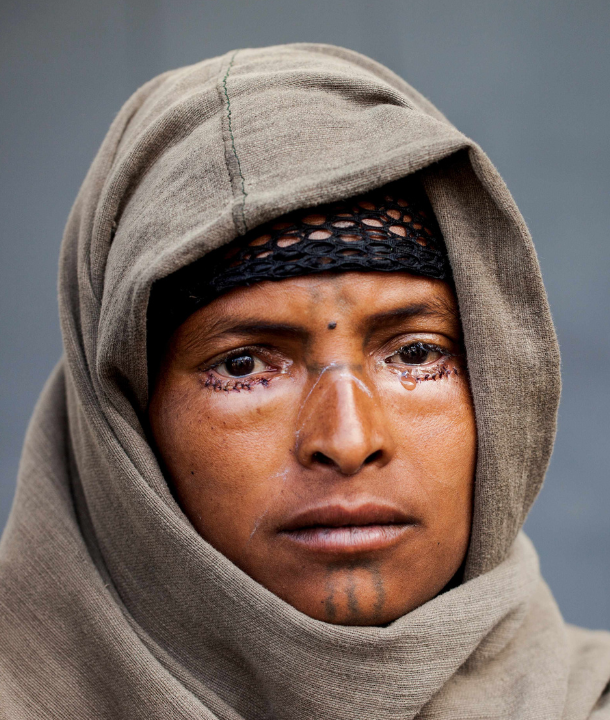 ethiopia_2014_azmera-tadessie-trachoma-emergency_610x720px.png