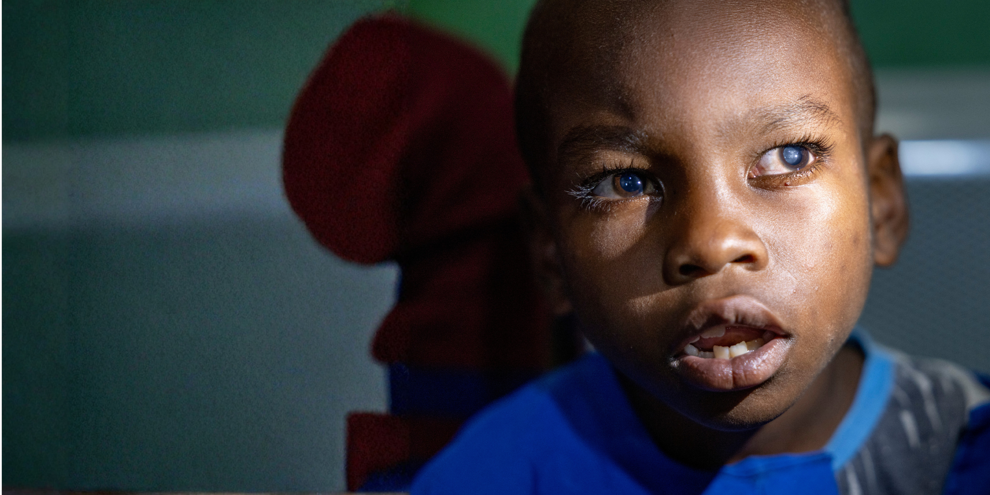 Rwanda_Blaise_Cataract.png